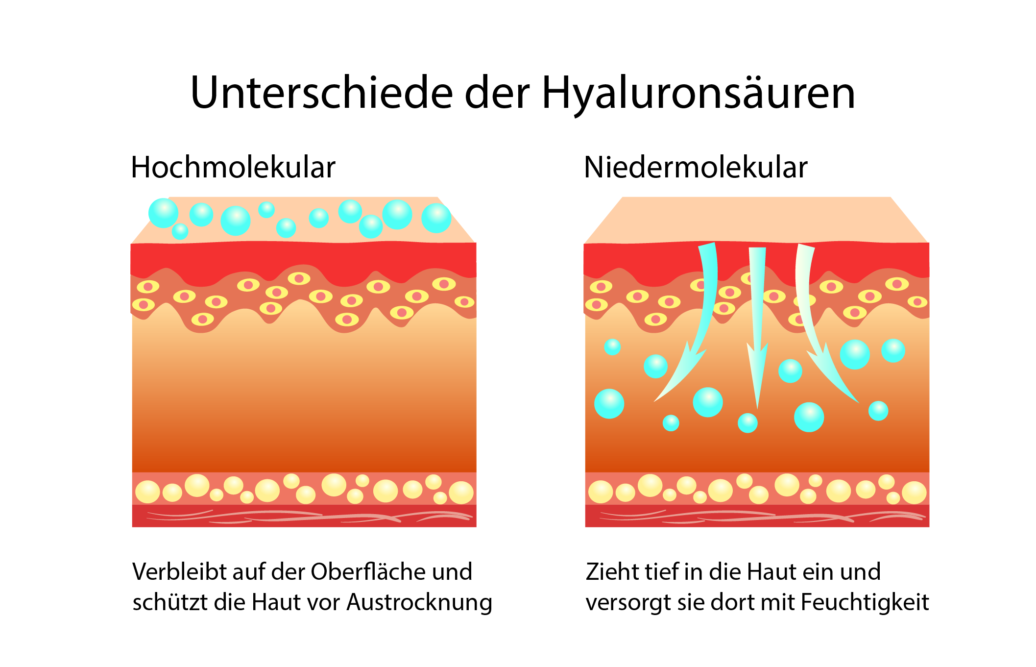 Nieder und Hochmolekulare Hyaluronsäure - Unterschiede
